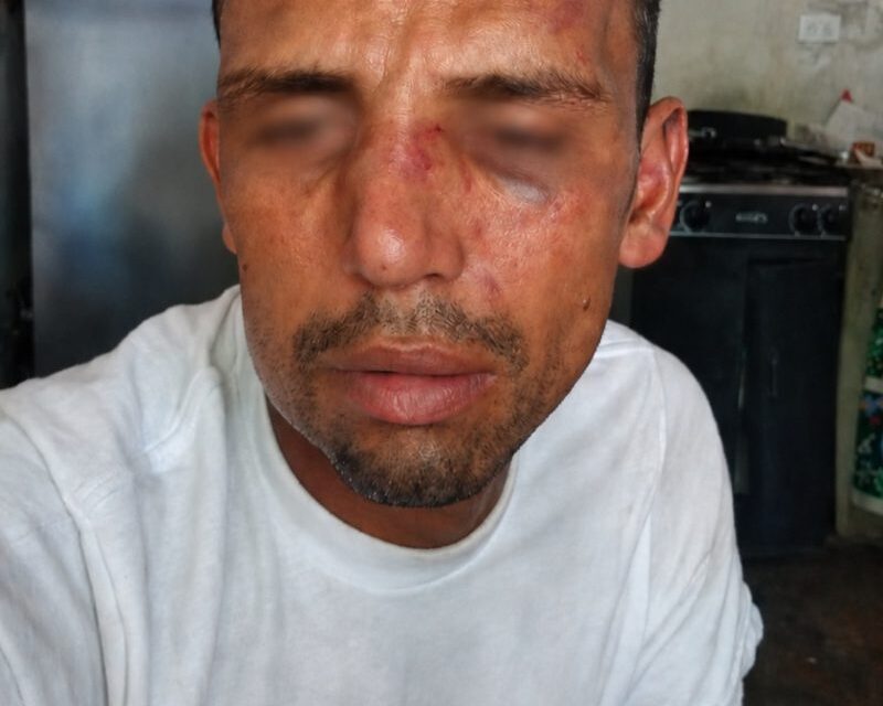 Militares retienen y torturan a campesino en Catatumbo, Colombia