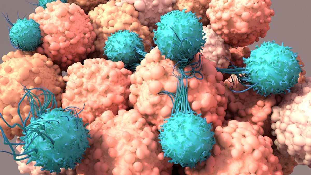 Nueva terapia reprograma defensas contra el cáncer sin extraer células
