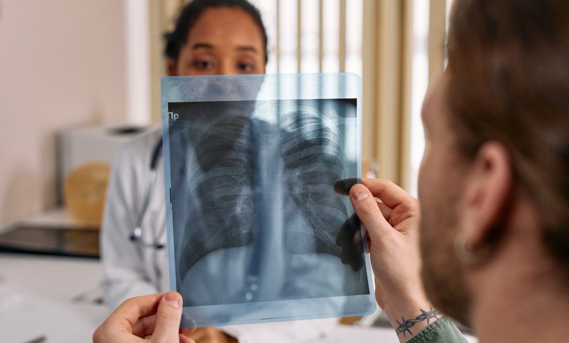 Detectan biomarcadores que relacionan contaminación y cáncer de pulmón