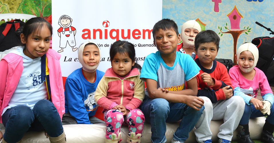 Aniquem financiará cirugías gratuitas para 35 pacientes con secuelas de quemaduras en Arequipa
